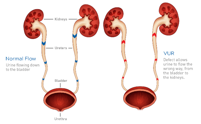 ΚυστεοΟΥρητηρική Παλινδρόμηση (ΚΟΥΠ)